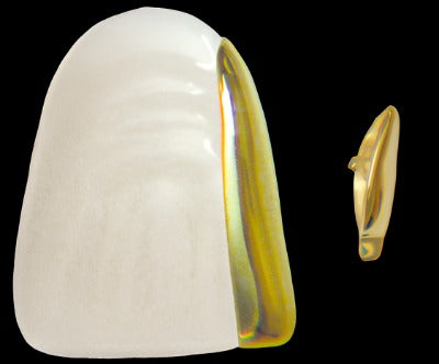 Dentures: Slit - iZi Tooth Jewellery